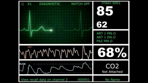Кардиомонитор | Пульс | Ритма сердечного слежение