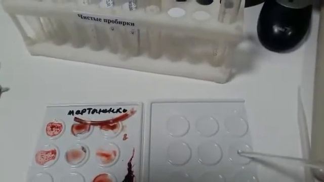 Определение группы крови. Резус фактор. Blood type determination. Blood Types. смотреть онлайн