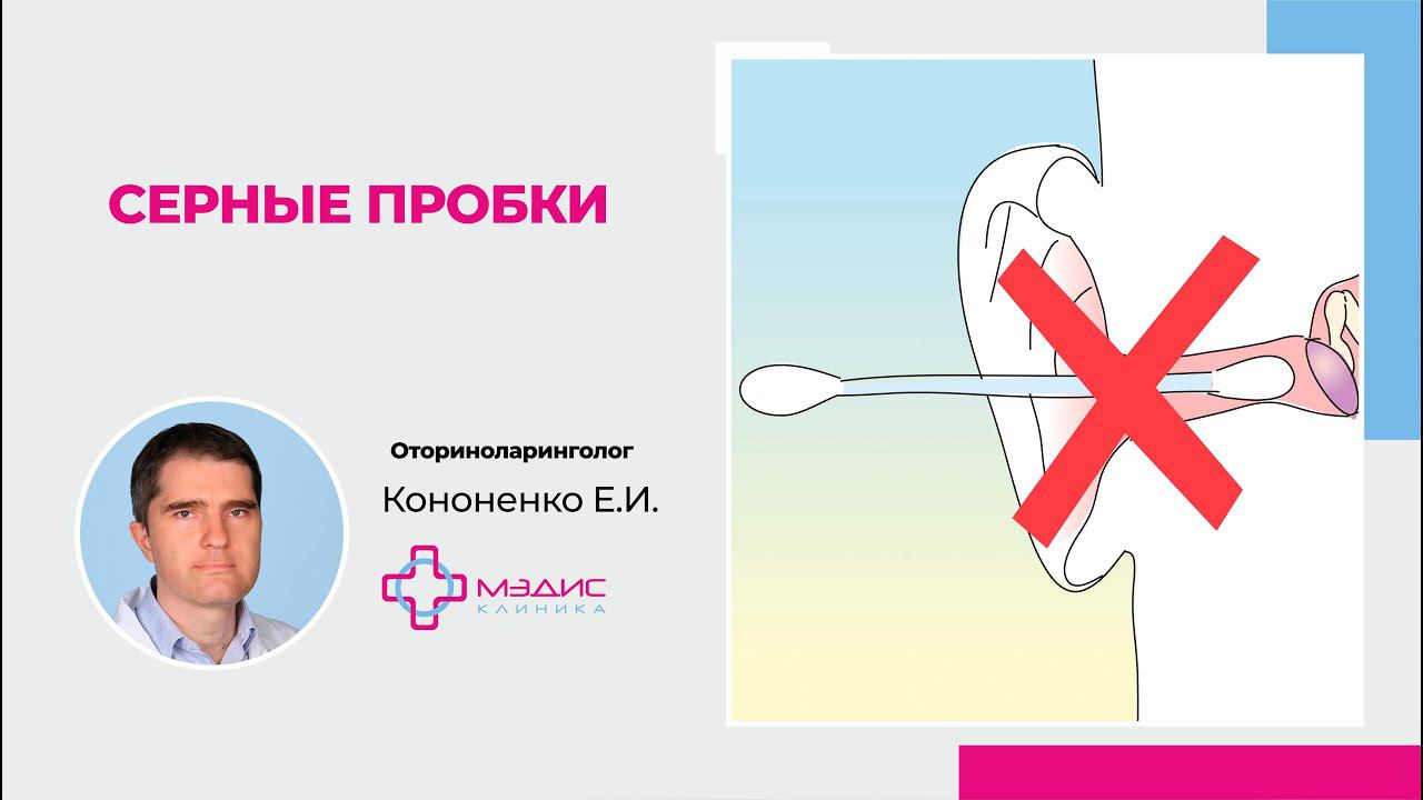 115.15. Серные пробки.Что делать с серными пробками. Кононенко Евгений Игоревич, ЛОР
