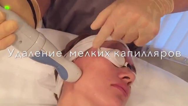 Лазерная шлифовка и фотоомоложение в одну процедуру смотреть онлайн