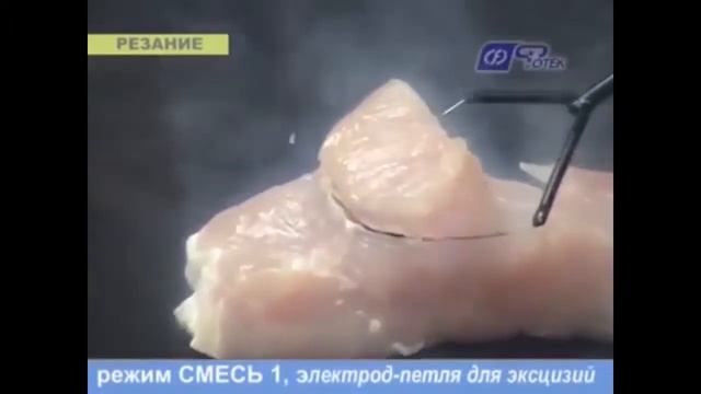 Удаление папиллом и родинок на аппарате «Фотек» смотреть онлайн