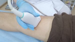 УЗИ коленного сустава