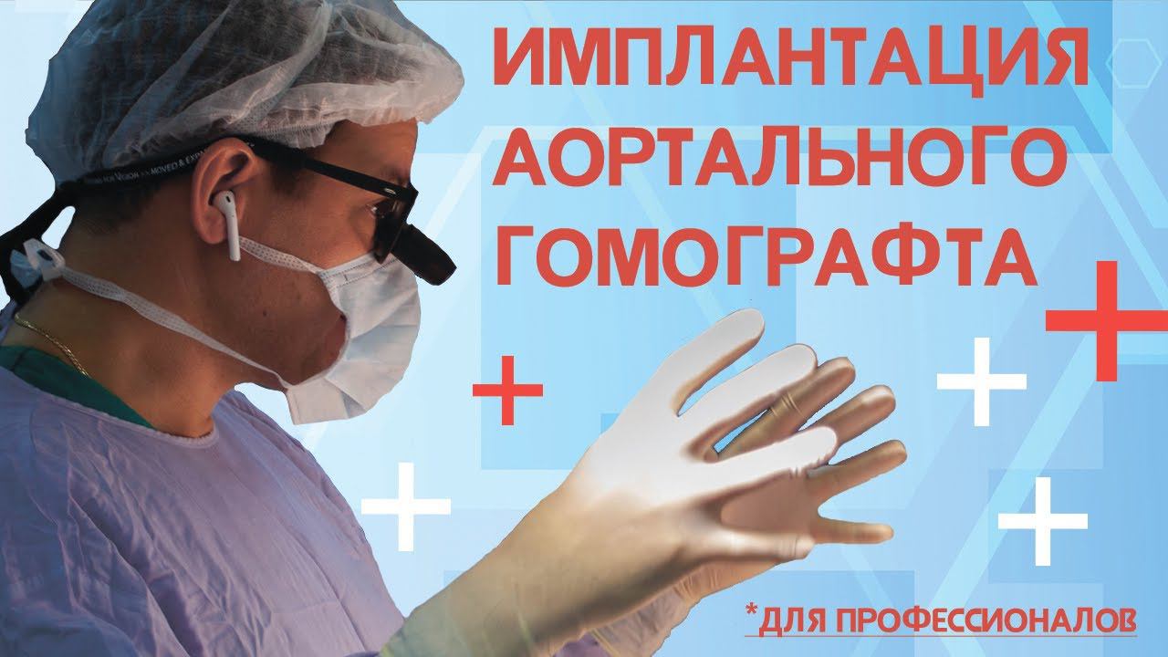 Имплантация гомографта после операции Озаки. Видео для профессионалов. Хирург Роман Комаров.