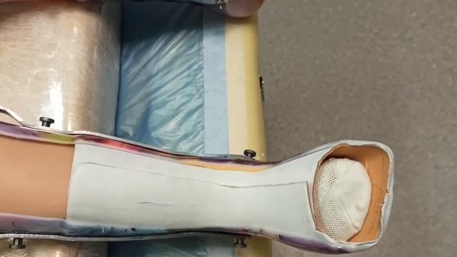 Подопечная фонда Катя Ф. и процесс изготовления туторов смотреть онлайн