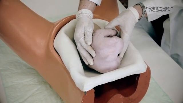 Діагностика вагітності в пізні терміни прийоми Леопольда-Левицького. Людмила Козирацька смотреть онлайн