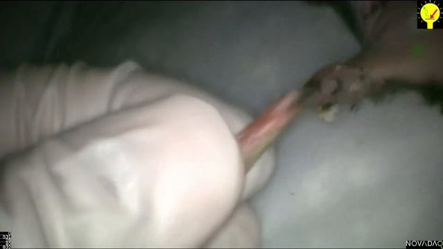 mouse lymph node mapping by ICG смотреть онлайн