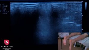 #УЗИ голеностопного сустава техника сканирования.