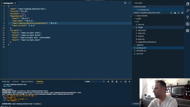 React Loading Skeleton Component смотреть онлайн