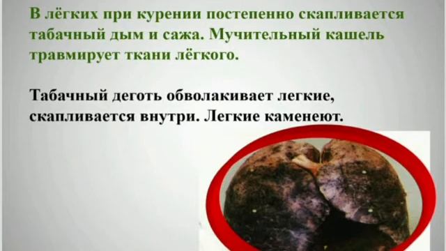Урок здоровья «От сигареты откажись! И без нее прекрасна жизнь!» смотреть онлайн