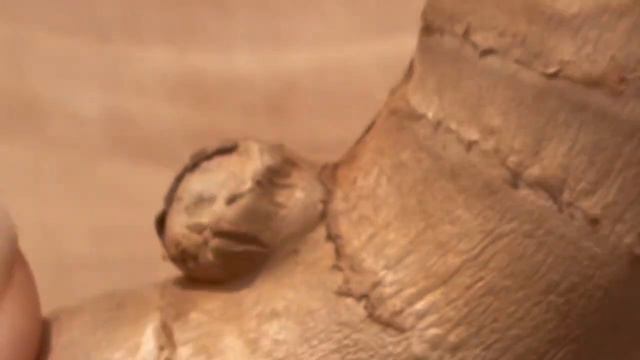 Muče vas bol u grlu, kašalj ili vam je začepljen nos? Ovo je jednostavno rješenje za vas! смотреть онлайн