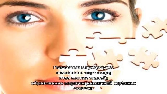 SMAS-лифтинг – все, что нужно знать о глубокой подтяжке