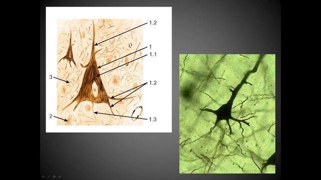 Кора полушарий смотреть онлайн