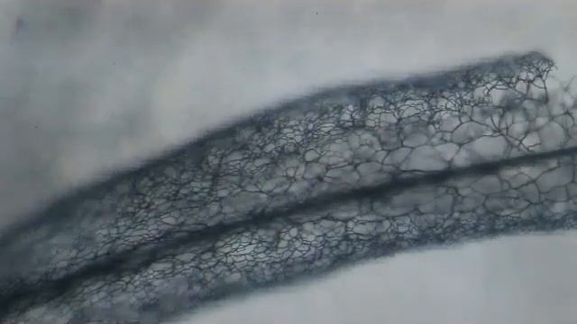 Observing the capillitium of Stemonitis смотреть онлайн