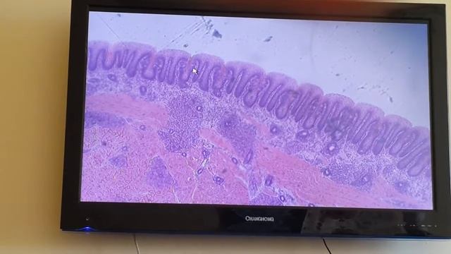 Гистология Язык [Пищеварительная система] смотреть онлайн