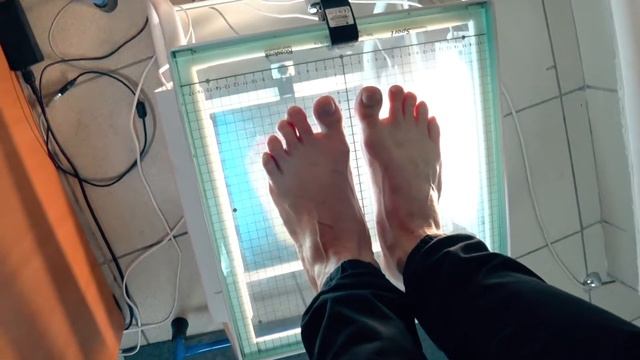 Как выбрать ортопедические стельки смотреть онлайн