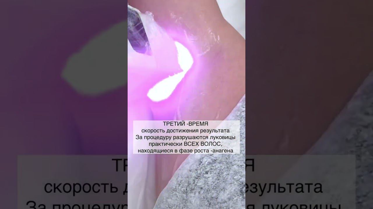 Премиум #лазернаяэпиляция MeDioStar NEXT Pro с уникальными насадками смотреть онлайн