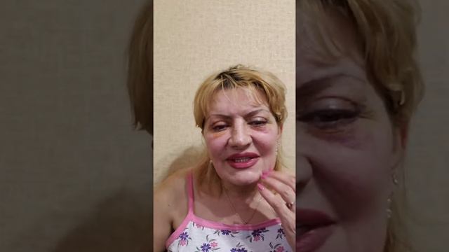 Третий день после блефорапластики смотреть онлайн