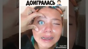 Шок! У девочки выпал глаз