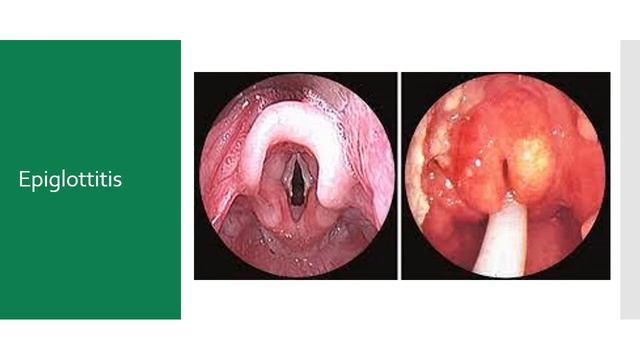 Paramedic Respiratory Emergencies смотреть онлайн