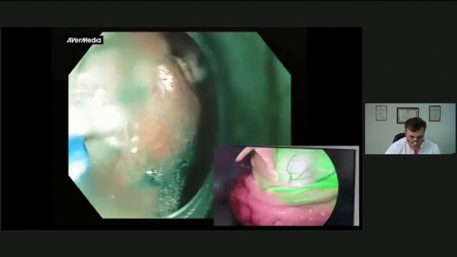 Новое в диагностической и оперативной эндоскопии (продолжение) смотреть онлайн
