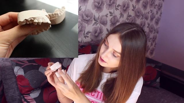 СНЯЛИ БРЕКЕТЫ Моя Ужасная История смотреть онлайн