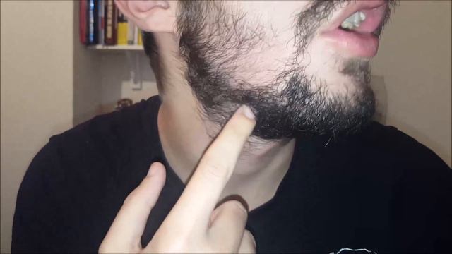 Minoxidil Beard | Week 15 | Minoxidil 5% For Beard Growth | #FacialFuzzFridays