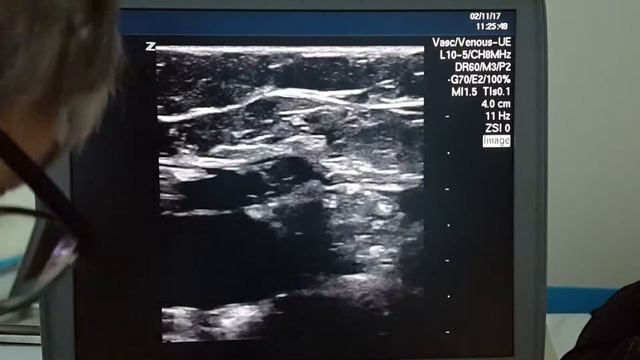 Контроль после лазера смотреть онлайн