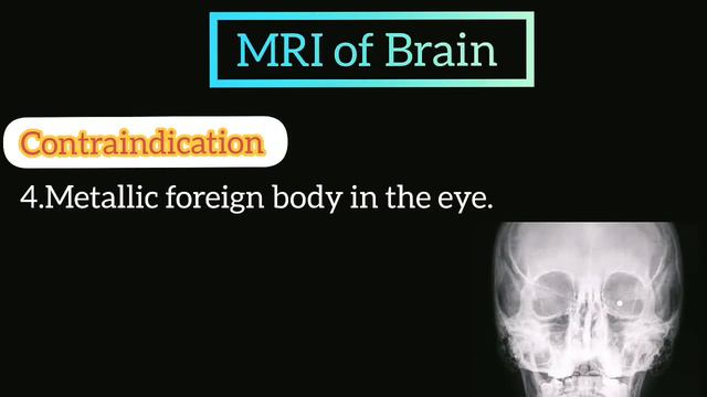 MRI Indication /&¶ Contraindications Of Brain_- MRI Of Brain 🧠