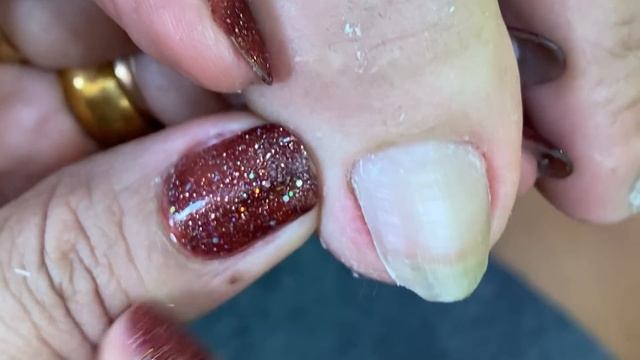 How to Repair Nails easy #336 смотреть онлайн
