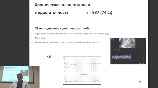 11.02.2015 Синдром внезапной смерти плода смотреть онлайн