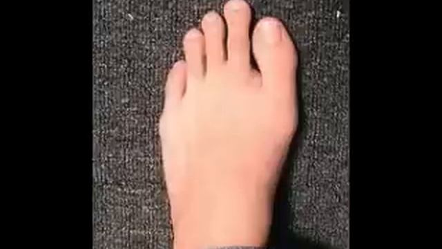 Rabih Abou Khalil - Morton's foot смотреть онлайн