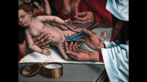 Circumcision and FGM