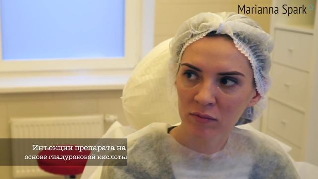 Как убрать ТЕМНЫЕ (СИНИЕ) КРУГИ под глазами?! ?️?️ Коррекция филлерами. Макс Адам Шерер смотреть онлайн