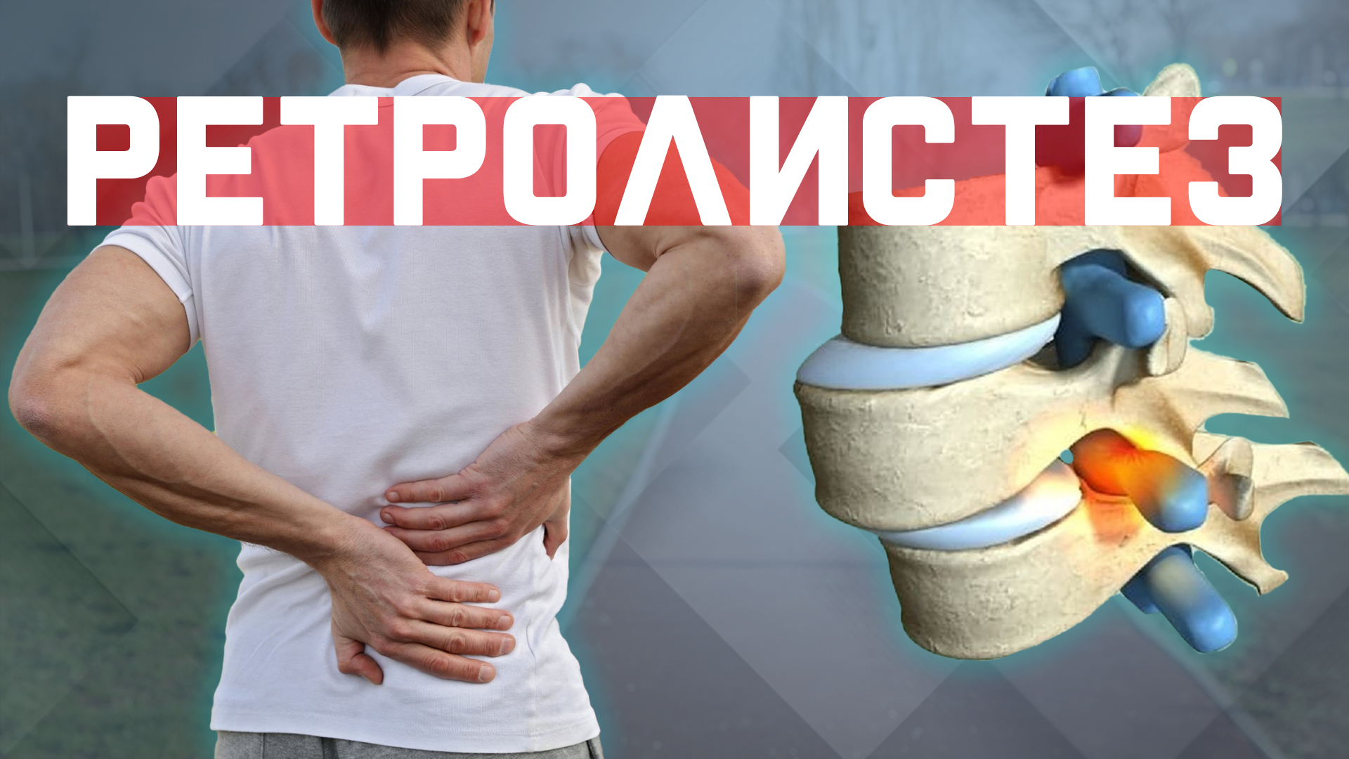 РЕТРОЛИСТЕЗ/АНТЕЛИСТЕЗ Что делать? Упражнения. Как укрепить мышцы таза?