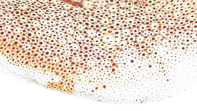 Dancing Chromatophores of the squid, Loligo pealeii смотреть онлайн