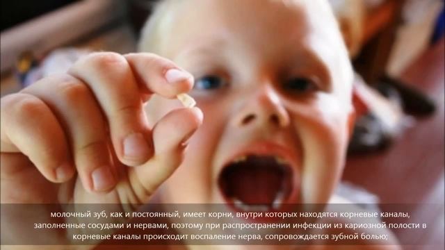 Лечение кариеса молочных зубов у детей - ZUBolel.ru смотреть онлайн