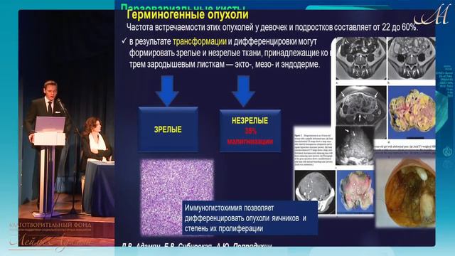Опухоли у детей и подростков, Л.В.Адамян, Е.В.Сибирская, А.Ю. Попрядухин, 20.11.2016 смотреть онлайн