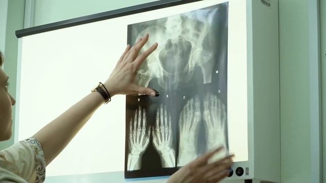 Институт Ревматологии им. В.А. Насоновой смотреть онлайн