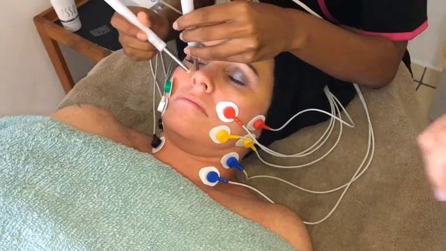 Non-Surgical Facelift