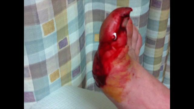 Gio's busted toe. Gross! смотреть онлайн