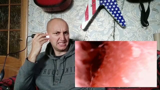 ЛИЦО ПОД МИКРОСКОПОМ. ШОКИРУЮЩАЯ ПРАВДА. ЭКСПЕРИМЕНТ НАД ЧЕЛОВЕКОМ смотреть онлайн