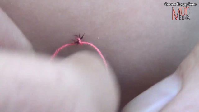 Как защитить себя от клещей смотреть онлайн