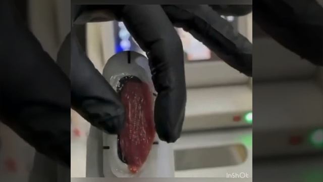 Как работает Смас лифтинг смотреть онлайн