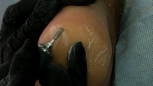 ?ПЕДИКЮР Пошагово. ТРЕЩИНЫ НА ПЯТКАХ. педикюр ДОМА. DIY Pedicure at Home. Extremely Calloused Feet