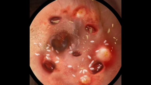 ASMR Чистка ушей ?/ уход за ушами/ уход за кожей смотреть онлайн