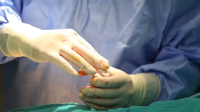 Терапия стволовыми клетками в ортопедии смотреть онлайн