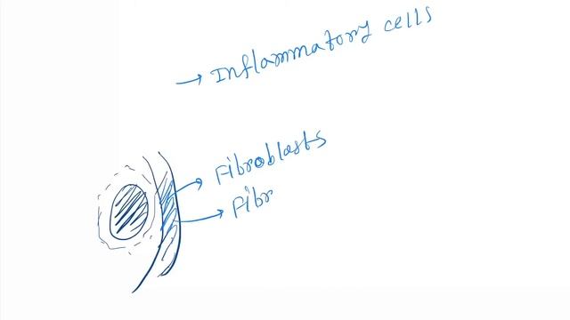 Actinomycosis Histopathology features смотреть онлайн