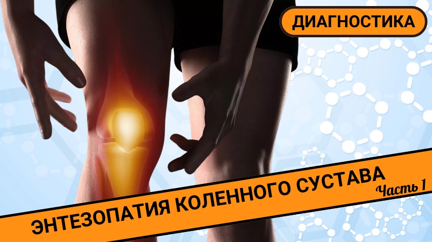 ПОЧЕМУ БОЛИТ КОЛЕНО? || Энтезопатия коленного сустава. Диагностика (Часть 1) смотреть онлайн