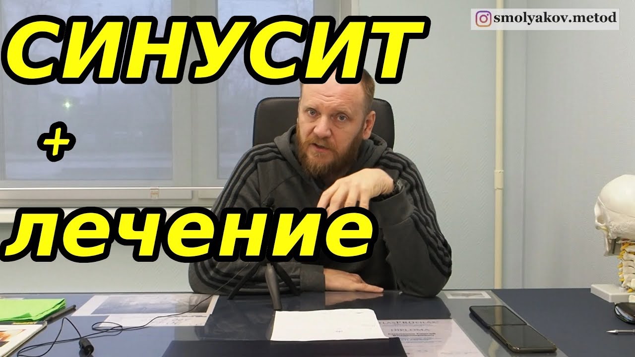 Причина синусита. Как лечить синусит? Воспаление пазух носа причина. Хронический синусит.