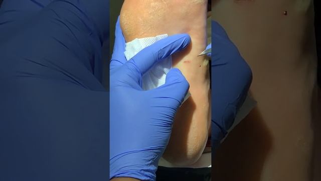 Guess the Foreign Body? смотреть онлайн